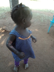 A little girl from Malakal whose mother was shot.